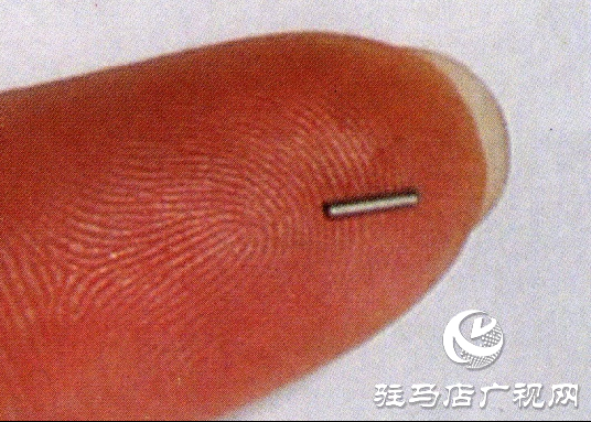 駐馬店市第一人民醫院：小粒子新突破，腫瘤放療科成功開展放射性粒子植入術