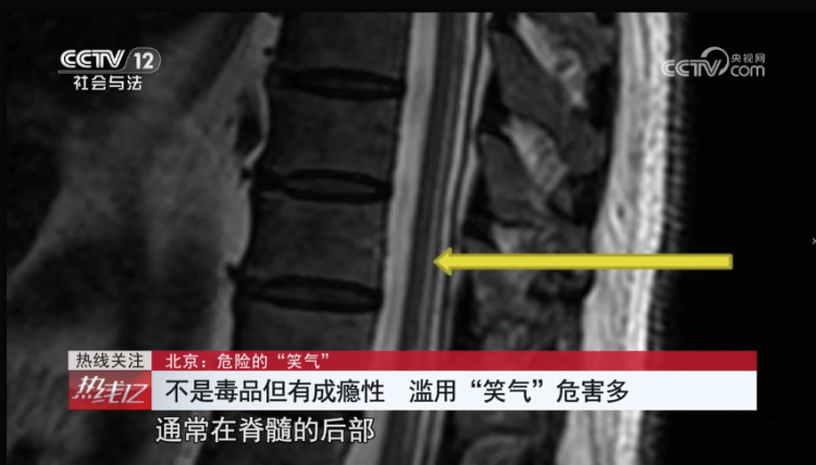  成癮、致幻，嚴重可致死！它不是毒品，卻像毒品一樣危險
