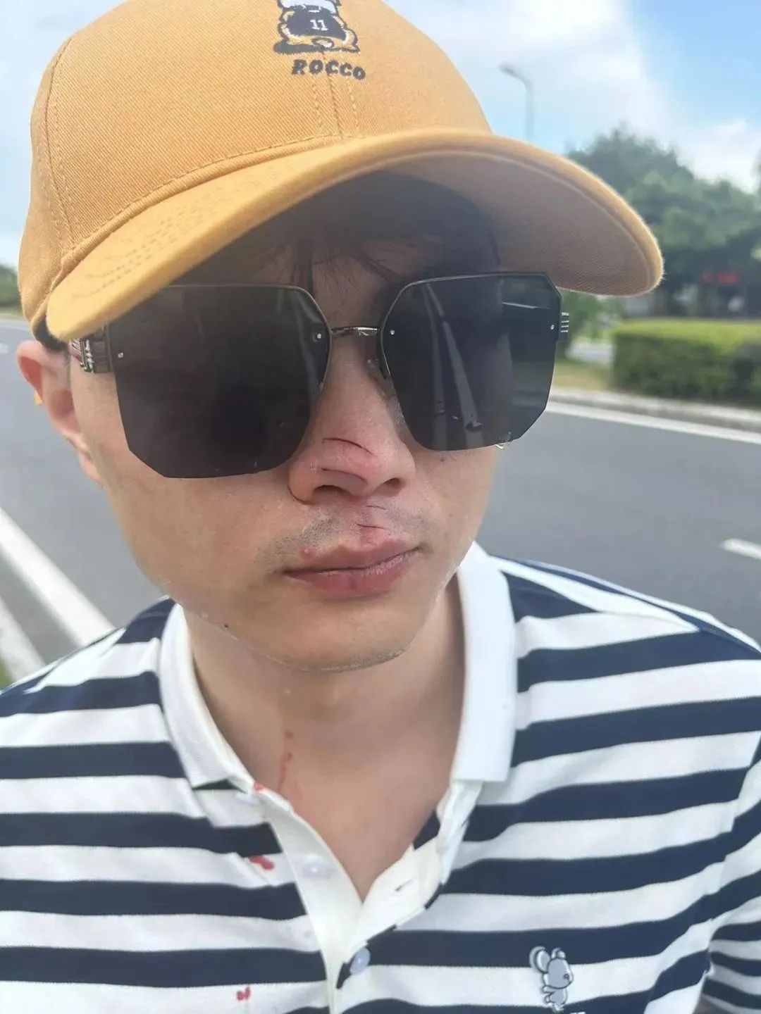 無人機傷人，飛手該擔何責？律師解讀