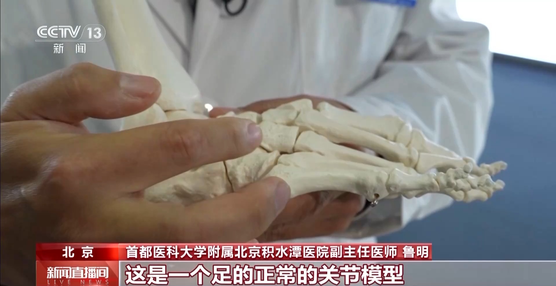 瘋狂種草碳板跑鞋？醫生：足底筋膜炎警告！
