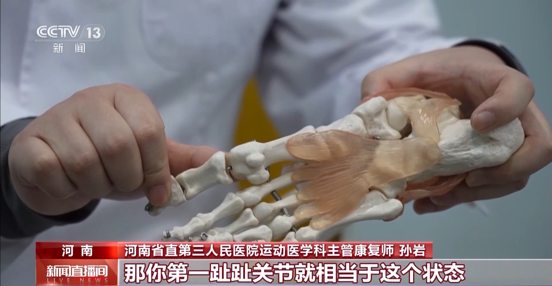 瘋狂種草碳板跑鞋？醫生：足底筋膜炎警告！