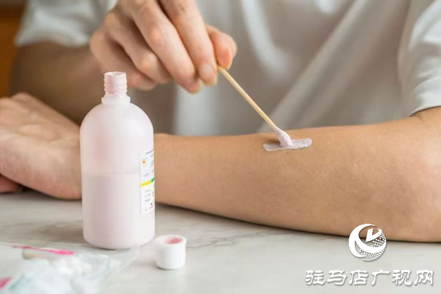 爐甘石洗劑并非“萬能神藥” 這些情況要慎用！