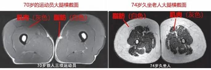 運動是加速衰老，還是延緩衰老？真相揭開